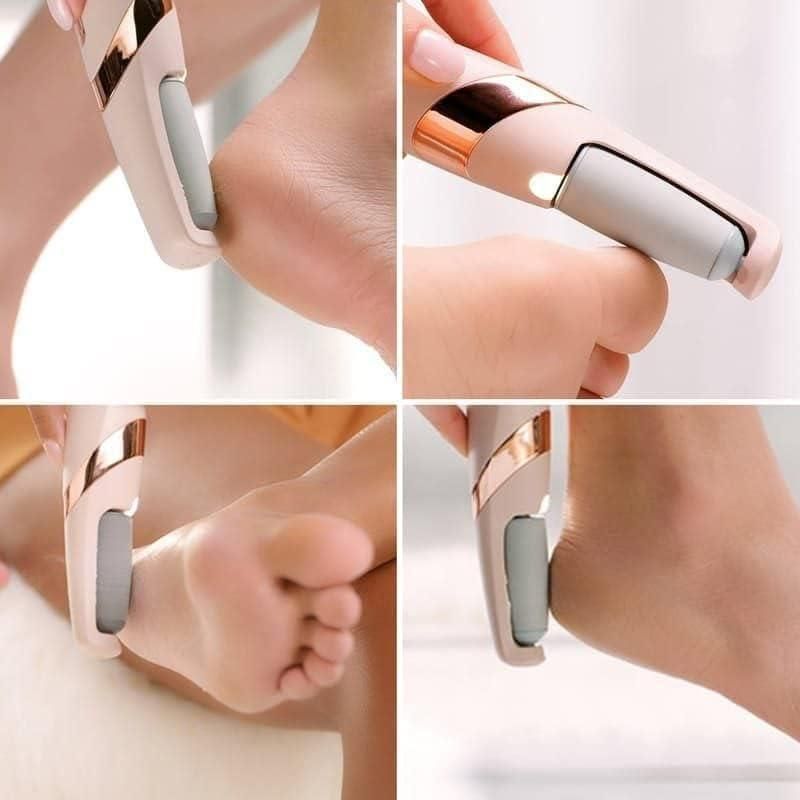 Electronic Callus Remover